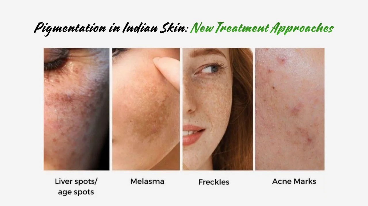 Pigmentation in Indian Skin: Causes, Types, and Effective Clinical Solutions in Mumbai